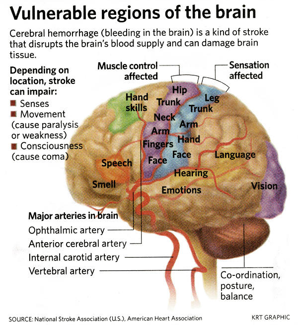 Vulnerable Regions of the Brain
